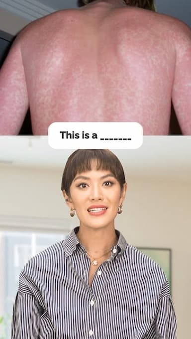 injuries-1