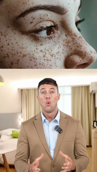 marks-on-the-skin